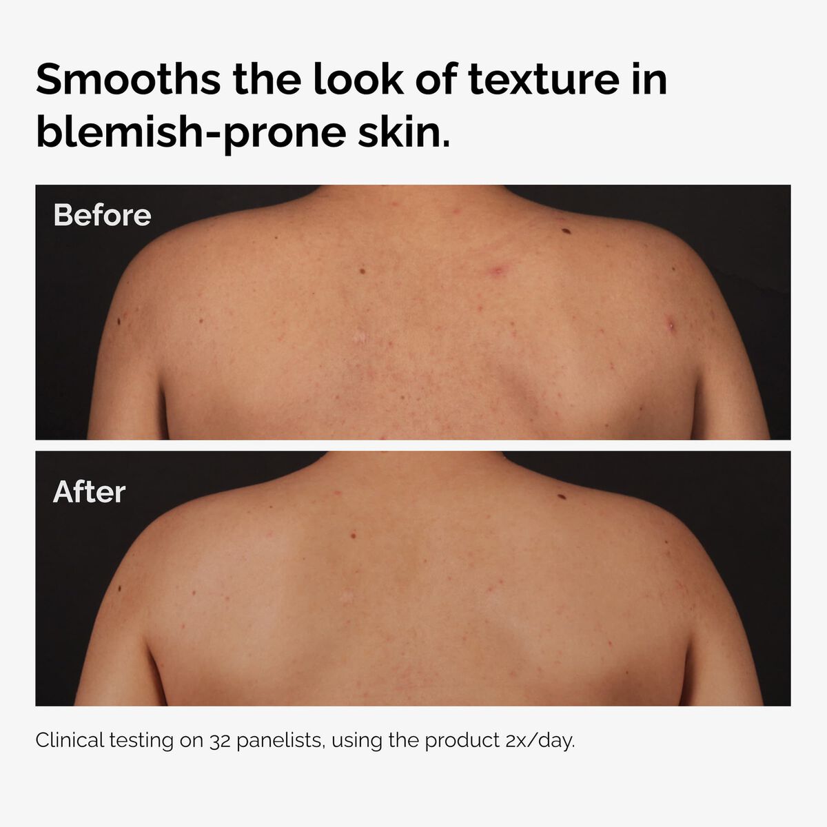 Serum Salicylic Acid 0.5% Body Serum